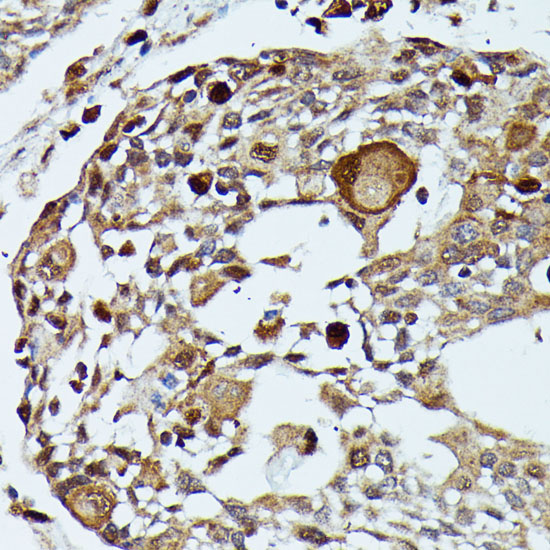 Anti-MAP3K3 Antibody (CAB16058)