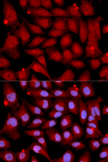 Anti-MAP2K6 Antibody (CAB2575)