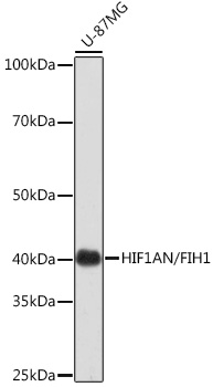 Anti-HIF1AN/FIH1 Antibody [KO Validated] (CAB3701)