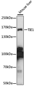 Anti-TIE1 Antibody (CAB15104)