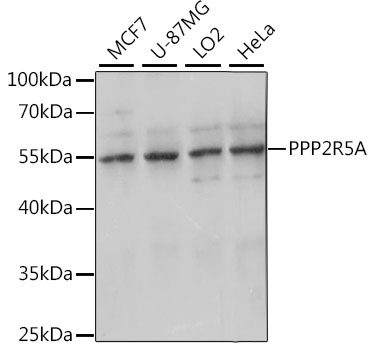 Anti-PPP2R5A Antibody (CAB15706)