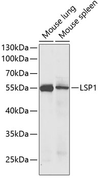 Anti-LSP1 Antibody (CAB5617)