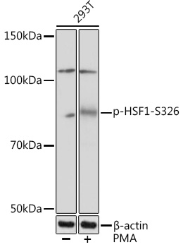 Anti-Phospho-HSF1-S326 Antibody (CABP1140)