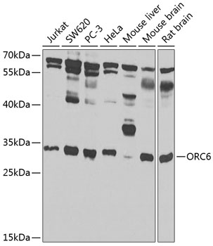 Anti-ORC6 Polyclonal Antibody (CAB7966)