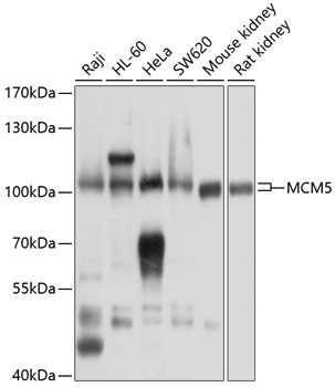 Anti-MCM5 Antibody (CAB13514)