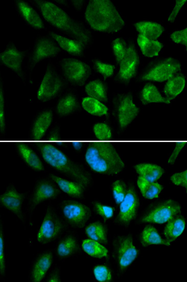 Anti-KIR2DL3 Antibody (CAB1698)