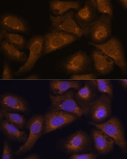 Anti-STAR Antibody (CAB16432)