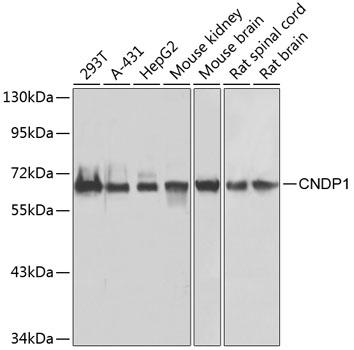 Anti-CNDP1 Antibody (CAB7485)