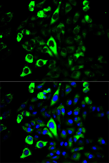 Anti-GZMB Antibody (CAB2557)