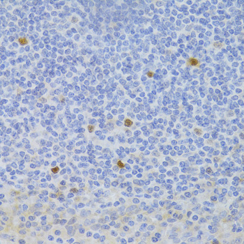 Anti-FCN1 Antibody (CAB6587)