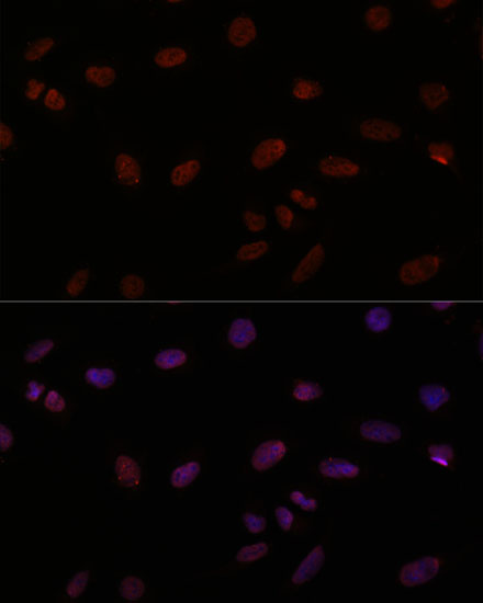 Anti-TTF1 Antibody (CAB18128)