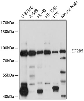 Anti-EIF2B5 Antibody (CAB10263)