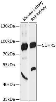 Anti-CDHR5 Antibody (CAB13850)