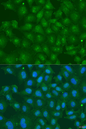 Anti-ZBTB20 Antibody (CAB15149)