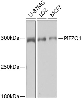 Anti-PIEZO1 Antibody (CAB4340)