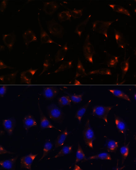 Anti-NOS1 Antibody (CAB12795)