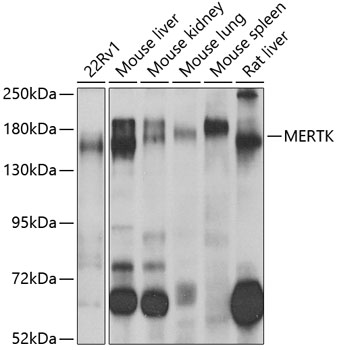 Anti-MERTK Antibody (CAB5443)