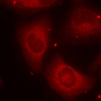 Anti-Phospho-LIM domain kinase 2-T505 Antibody (CABP0388)