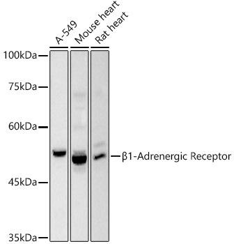 Western blot analysis of extracts of various cell lines, using ÃŽÂ²1-Adrenergic Receptor antibody at 1:1000 dilution. Secondary antibody: HRP Goat Anti-Rabbit IgG (H+L) at 1:10000 dilution. Lysates/proteins: 25ug per lane. Blocking buffer: 3% nonfat dry milk in TBST. Detection: ECL Basic Kit. Exposure time: 3s.