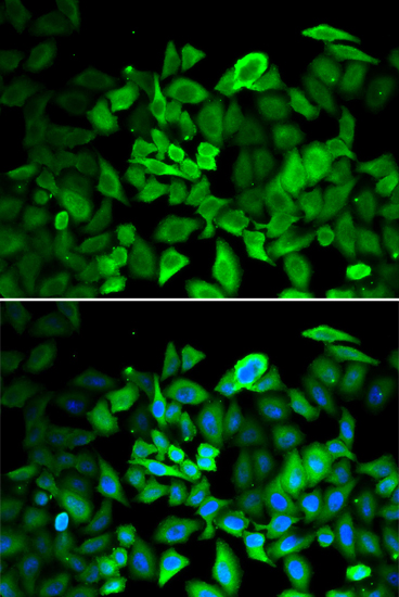 Anti-ANXA1 Antibody [KO Validated] (CAB1118)