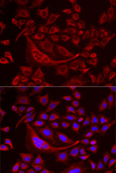 Anti-TUFM Antibody (CAB6423)