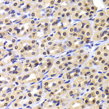 Anti-NUDC Antibody (CAB6678)