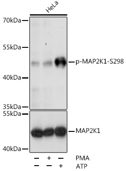 Anti-Phospho-MAP2K1-S298 Antibody (CABP0063)