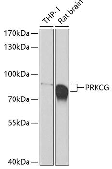 Anti-PRKCG Antibody (CAB7922)