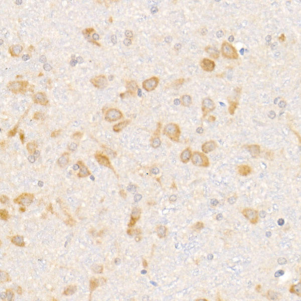 Immunohistochemistry of paraffin-embedded rat brain using eIF1A Rabbit mAb at dilution of 1:50 (40x lens). Perform high pressure antigen retrieval with 10 mM citrate buffer pH 6. 0 before commencing with IHC staining protocol.