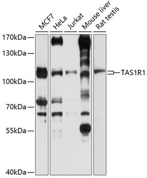 Anti-TAS1R1 Antibody (CAB10156)