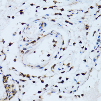 Anti-PSMD13 Antibody (CAB12485)