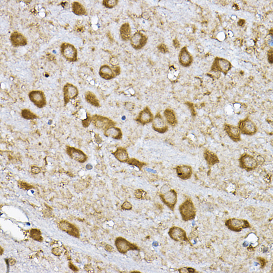 Anti-p70 S6 kinase Antibody (CAB16658)