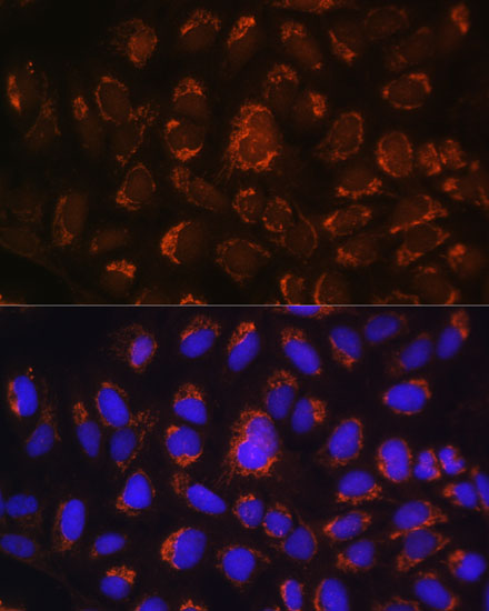 Anti-ART1 Antibody (CAB10103)