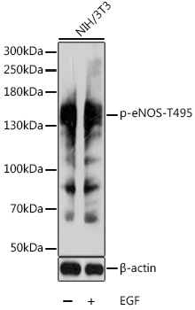 Anti-Phospho-eNOS-T495 Antibody (CABP0516)