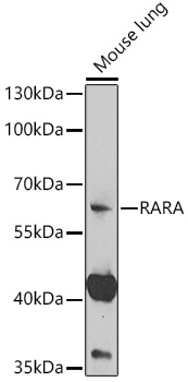 Anti-RARA Antibody (CAB14057)