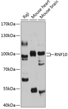 Anti-RNF10 Antibody (CAB12296)