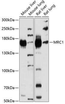 Anti-MRC1 Polyclonal Antibody (CAB8301)