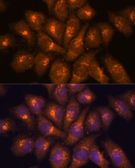 Anti-B3GNT4 Antibody (CAB15896)