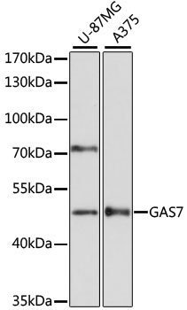 Anti-GAS7 Antibody (CAB14179)