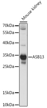 Anti-ASB13 Antibody (CAB15897)