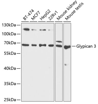 Anti-Glypican 3 Antibody (CAB1946)