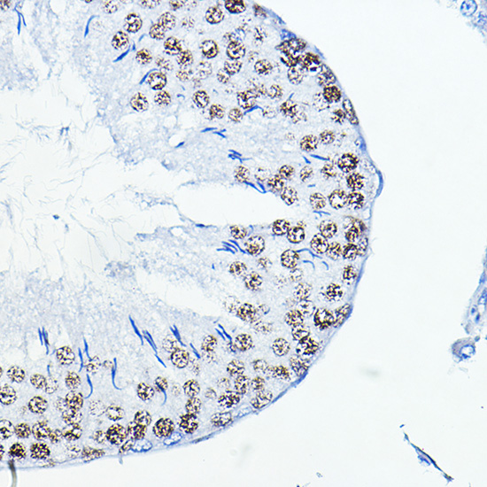 Anti-FOSL1 Antibody (CAB5372)