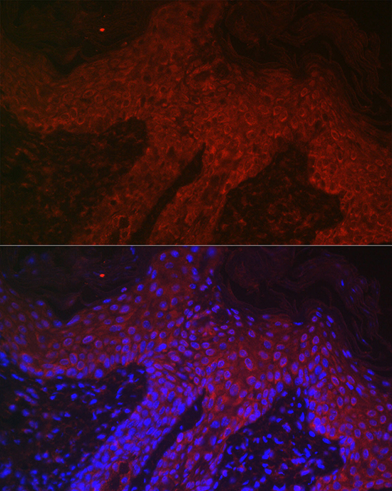 Anti-DKK2 Antibody (CAB14874)