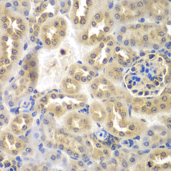 Anti-SULT2B1 Antibody (CAB7736)