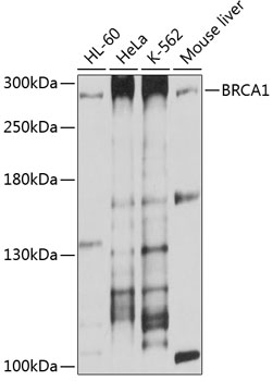 Anti-BRCA1 Antibody (CAB11034)