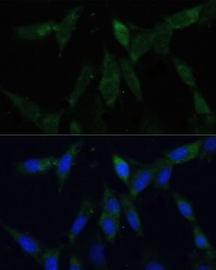 Anti-ZWINT Antibody (CAB6328)