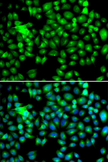 Anti-HSPB8 Antibody (CAB2514)