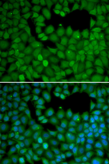 Anti-NET1 Antibody (CAB1213)