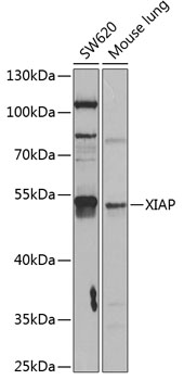 Anti-XIAP Antibody (CAB13277)