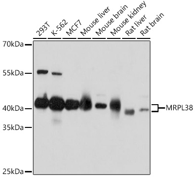 Anti-MRPL38 Antibody (CAB18239)